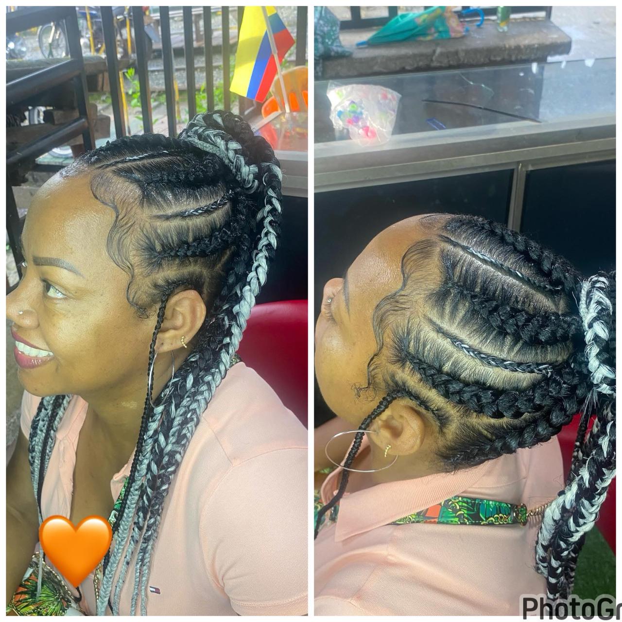 Riñones Estilo Cebolla